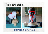 4분의 기적, 심폐소생술 (Cardio Pulmonary Resuscitation) -17