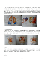 성인간호학 case - Acute Appendicitis (급성 충수염), Pneumothorax (기흉)-8