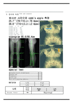 물리치료 SOAP NOTE scoliosis 측만증-3