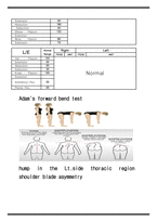 물리치료 SOAP NOTE scoliosis 측만증-4