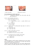 여성간호학실습 케이스스터디 (자궁경부상피내암 CIS) [간호진단 및 간호과정 2개]-3