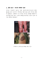 데이트 폭력 레포트-3