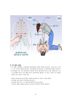 CPR심폐소생술 레포트-9