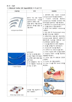 [건강과 간호] 동성리듬, EKG 리듬 PBL-12