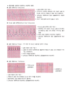 [건강과 간호] 동성리듬, EKG 리듬 PBL-15