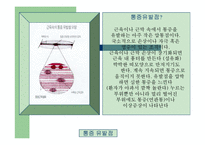 [통증의학] 근막통[Myofascial Pain] 과 만성통증[chronic pain]-3