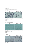 [일반생물학] Gram [그람]염색에 의한 미생물의 동정-4