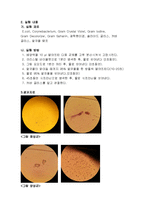 [실험보고서] 세균의 분별 염색법-2