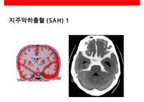 뇌심혈관질환의 이해 및 예방-8