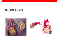 뇌심혈관질환의 이해 및 예방-16