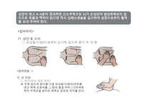 운동과 건강 응급처치-9